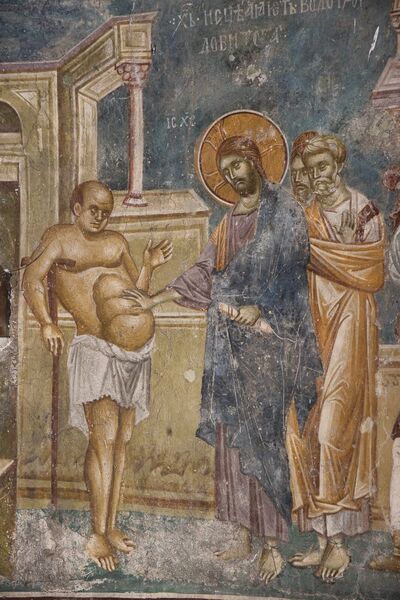 Healing a man from dropsy