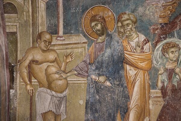 Healing a man from dropsy, detail