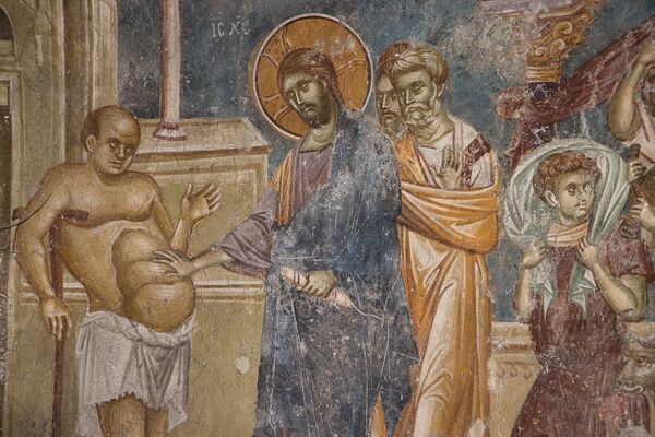 Healing a man with dropsy, detail