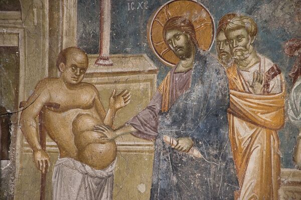 Healing a man from dropsy, detail