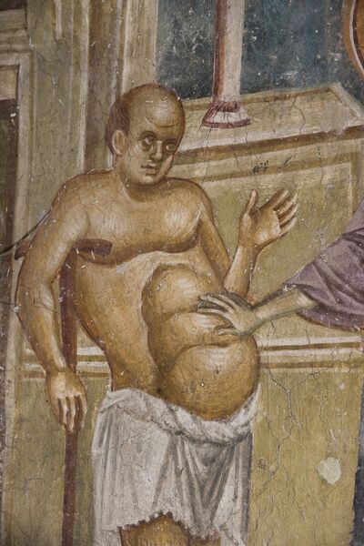 Healing a man from dropsy, detail