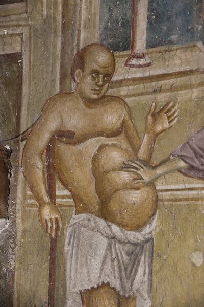 Healing a man from dropsy, detail